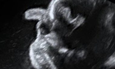 Proboscic main pic updated.jpg
