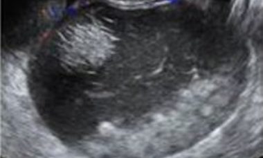 Adnexal pathology main pic.JPG