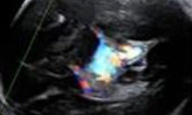 Vascular anomaly main pic.JPG