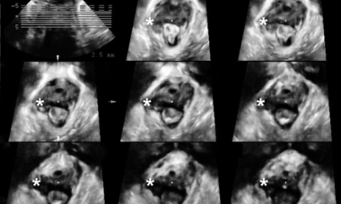 Urogyne Virtual Issue IMAGE_1.png