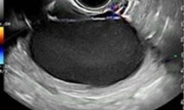 Free access in March 