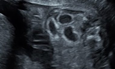 cover photo.jpg 1
