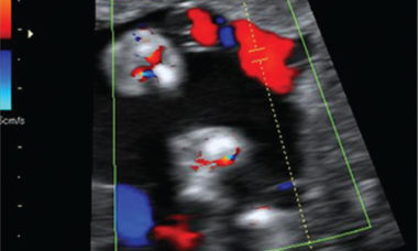 Khalil et al. Figure 4 middle panel_sFGR.jpg