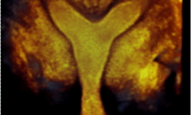 Gynecology main pic.png