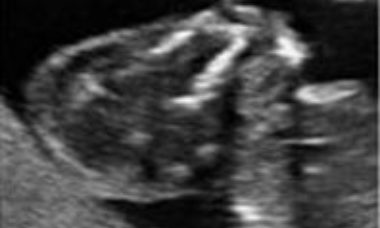 Abnormal skull contour main pic.JPG