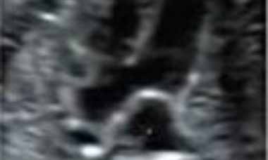 Fallot and variants main pic.JPG