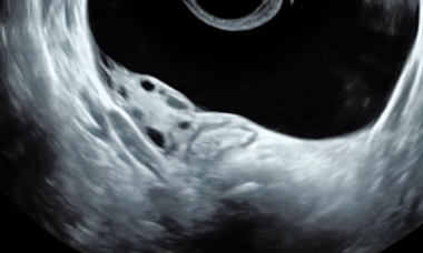 Acute pelvic pain webinar image.png