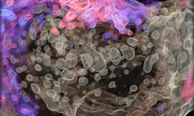 Uncommon early pregnancy webinar banner.png