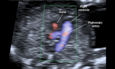 ‘One stop series’ Fetal First Trimester