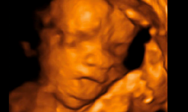 MAcroglossia.png