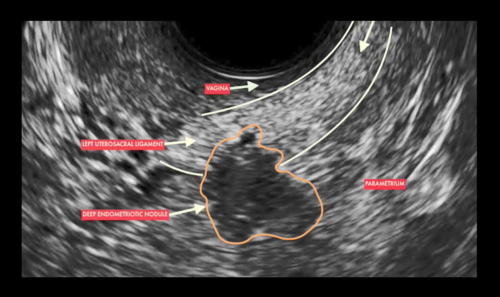 UOG video clip: Proposed technique to visualize and classify