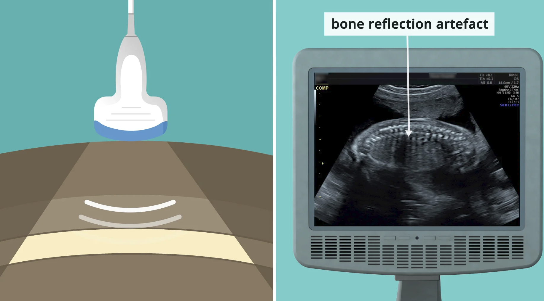 presentation ultrasound