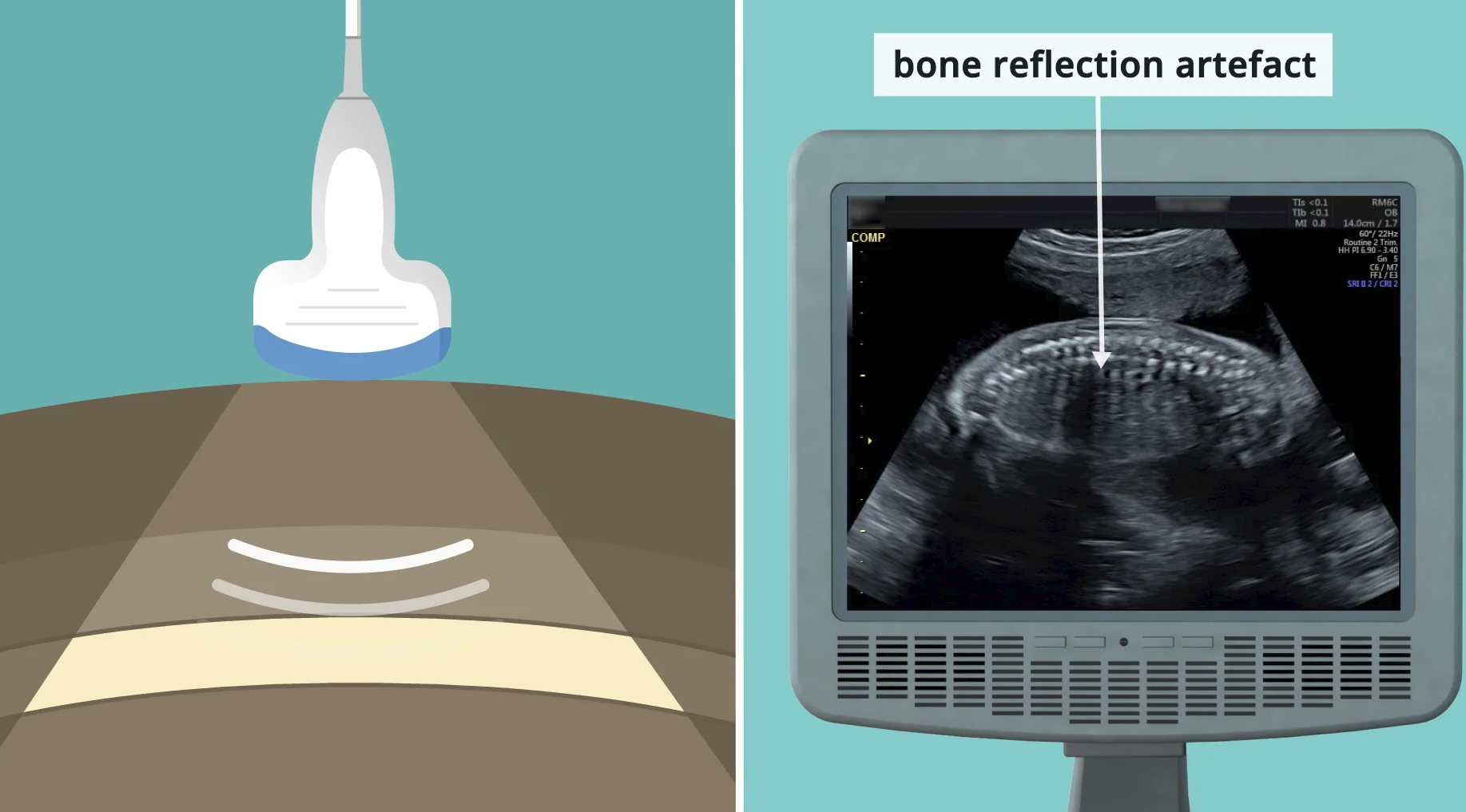 ultrasound imaging presentation